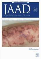 Angiotensin-converting enzyme and subclinical atherosclerosis in psoriasis: Is there any association? A case-control study