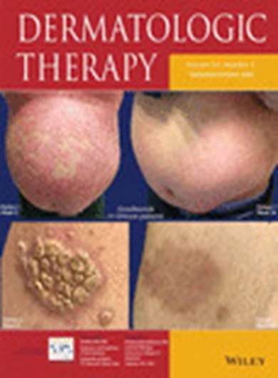 Efficacy and safety of cryotherapy, electrodesiccation, CO2 laser, and Er:YAG laser in the treatment of seborrheic keratosis
